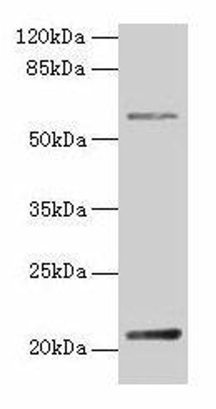 DUSP13 Antibody PACO36634