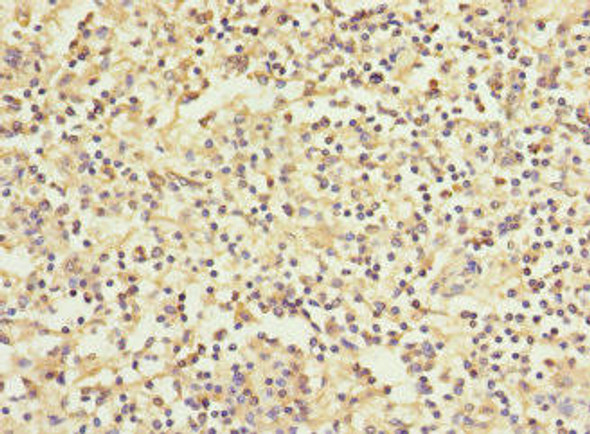 WFDC11 Antibody PACO37986