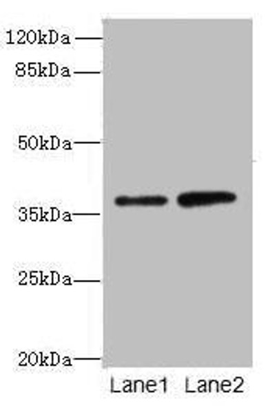 CLYBL Antibody PACO39630