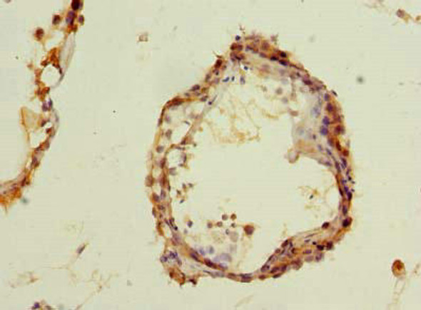 MCM9 Antibody PACO41734