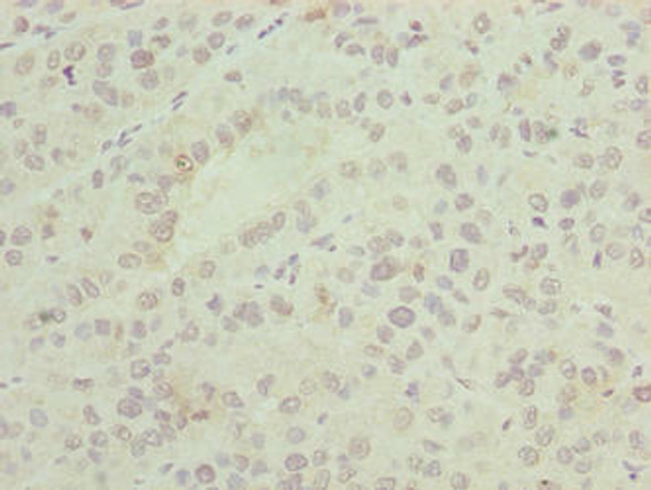 ASNSD1 Antibody PACO41990