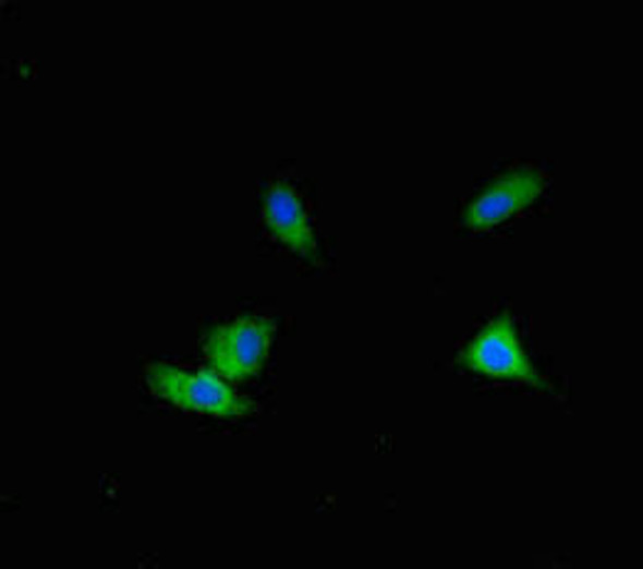 ALG12 Antibody PACO42102