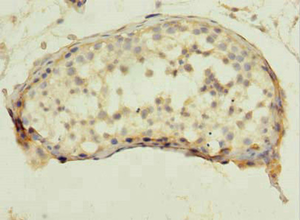 QTRT1 Antibody PACO42130