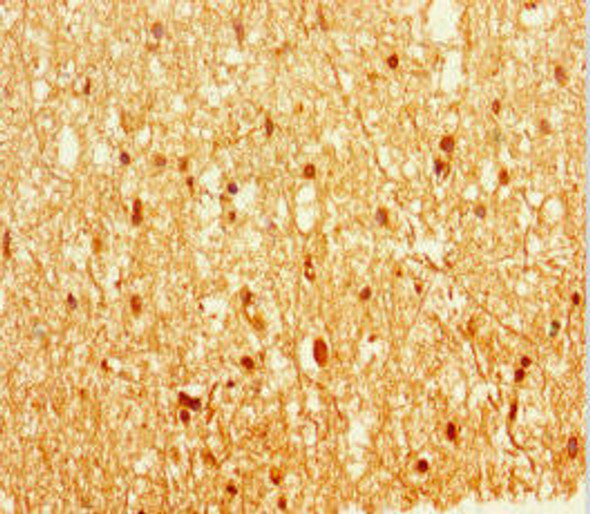 EPM2A Antibody PACO45806