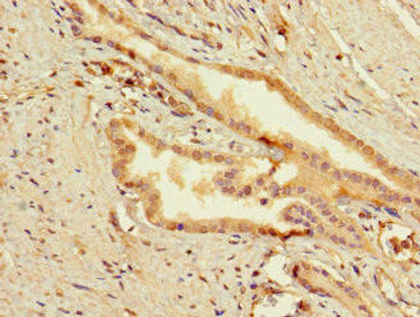 SLC25A10 Antibody PACO47162