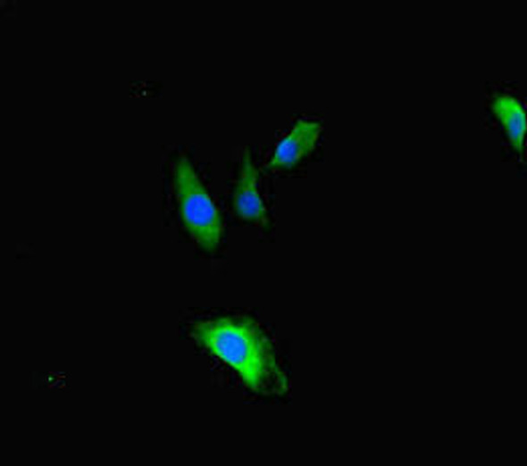 TBC1D24 Antibody PACO47222