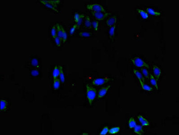 ABLIM1 Antibody PACO47274