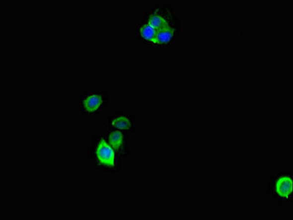 ANP32D Antibody PACO47302