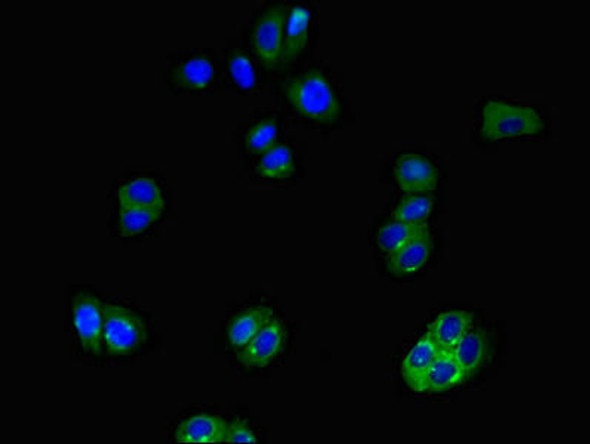 SLCO1B3 Antibody PACO48758