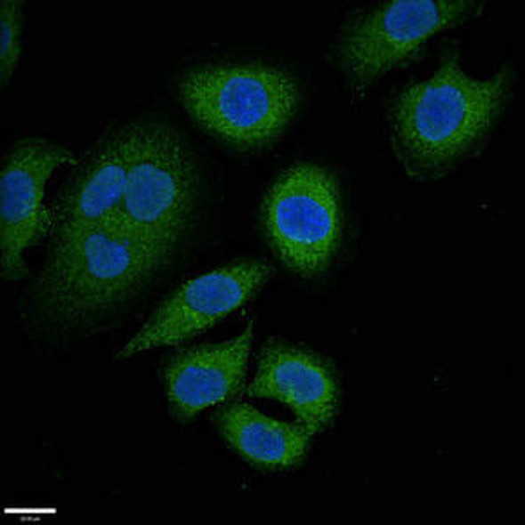 ABCC9 Antibody PACO49370