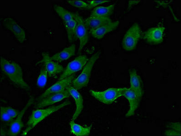 AHRR Antibody PACO49386