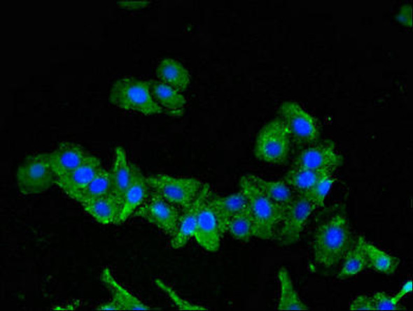 SEMA6A Antibody PACO51074