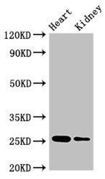 CSH2 Antibody PACO51450