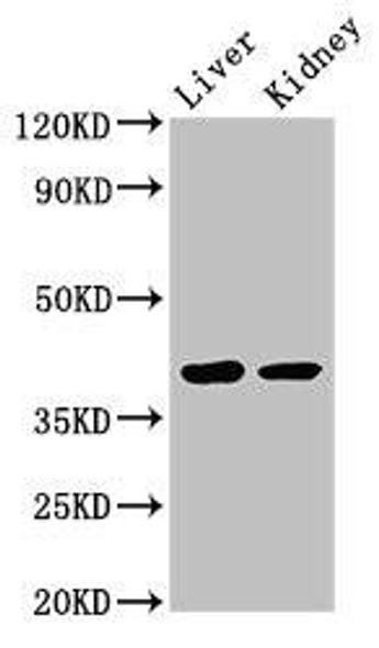 VASH2 Antibody PACO52494