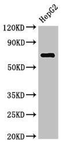 ST6GALNAC1 Antibody PACO52758