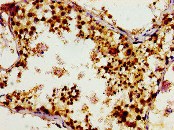 TUBGCP4 Antibody PACO55282