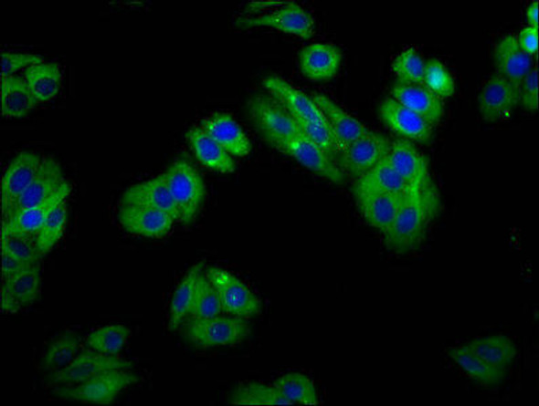 SLC22A25 Antibody PACO55962