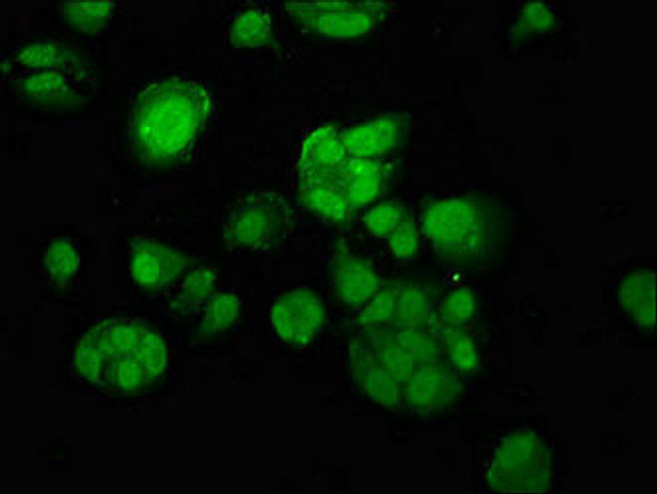 MACC1 Antibody PACO55982