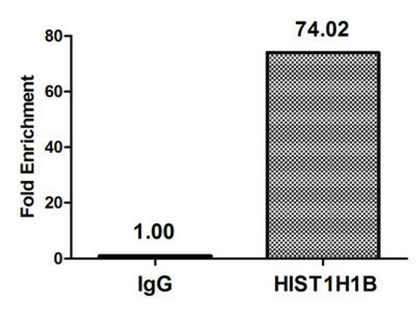 Acetyl-HIST1H1B K16 Antibody PACO56606