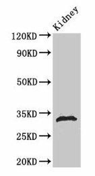 Phospho-HIST1H1B S188 Antibody PACO56608