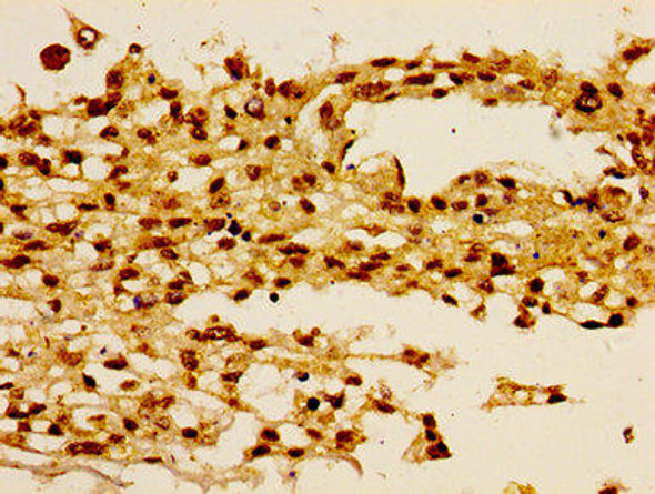 HIST1H1B Ab-16 Antibody PACO56609