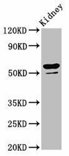 CYP8B1 Antibody PACO56776