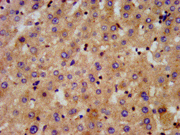 ATAT1 Antibody PACO57200