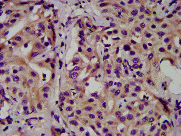 CEACAM16 Antibody PACO57696