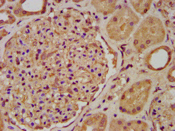 ENOSF1 Antibody PACO58204