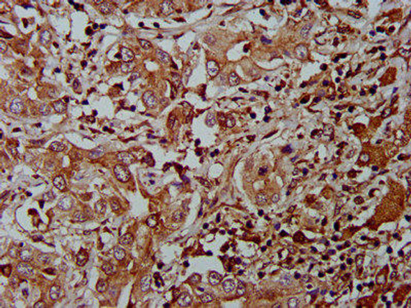 AHNAK2 Antibody PACO58272