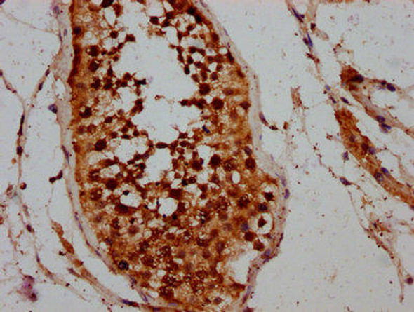 CCIN Antibody PACO58697