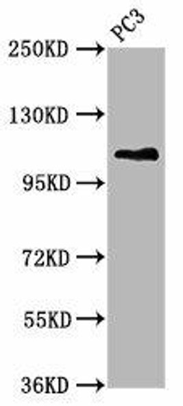 FAN1 Antibody PACO58997