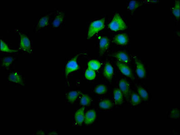 CLIP2 Antibody PACO59397