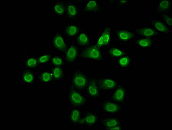 Formyl-HIST1H2BC K116 Antibody PACO59637