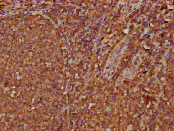 IGHA2 Antibody PACO59752