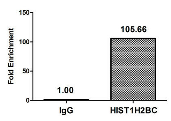 Acetyl-HIST1H2BC K11 Antibody PACO60474