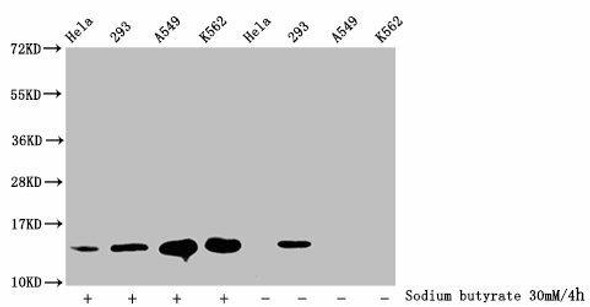 2-hydroxyisobutyryl-HIST1H2BC K20 Antibody PACO60492