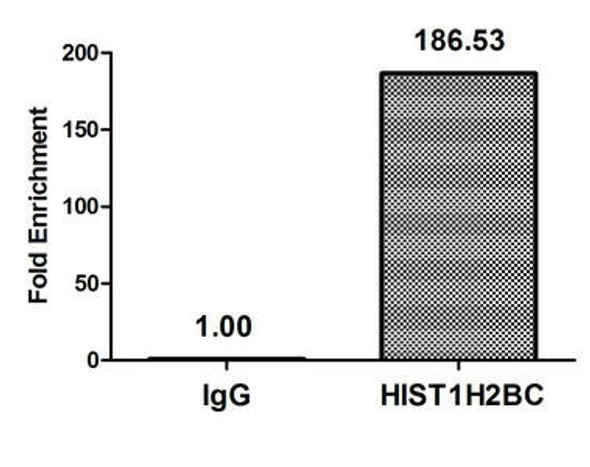 Acetyl-HIST1H2BC K116 Antibody PACO60506