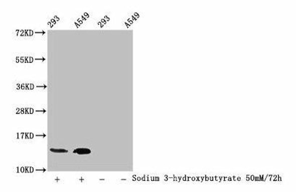 beta -hydroxybutyryl-HIST1H2BC K20 Antibody PACO60512