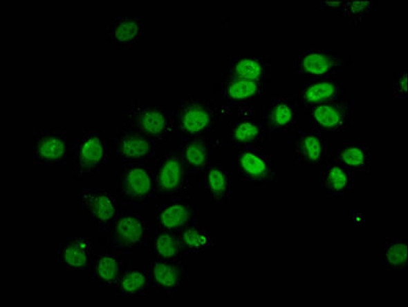 2-hydroxyisobutyryl-HIST1H2BC K12 Antibody PACO60519