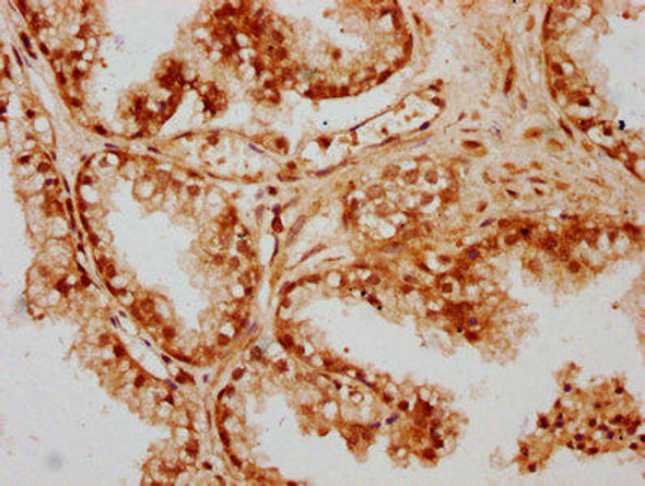 CPTP Antibody PACO60993