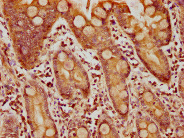 TMED6 Antibody PACO61101