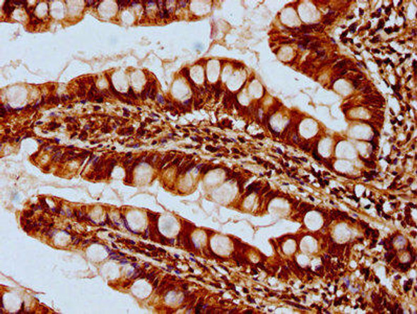 SYCE3 Antibody PACO62131