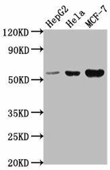 PRAMEF18 Antibody PACO62343