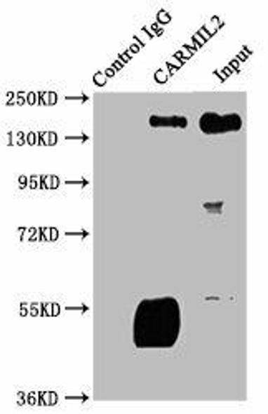 CARMIL2 Antibody PACO62483