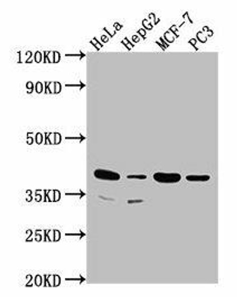 DUSP11 Antibody PACO62875