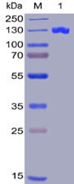 Human CD22 Recombinant Protein hFc-His Tag HDPT0005