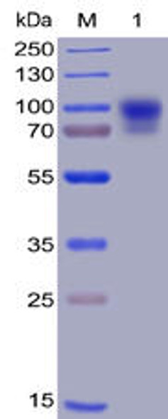 Human SIRPa Recombinant Protein hFc-His Tag HDPT0009