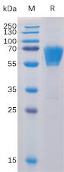 Human CD27 Recombinant Protein mFc-His Tag HDPT0013