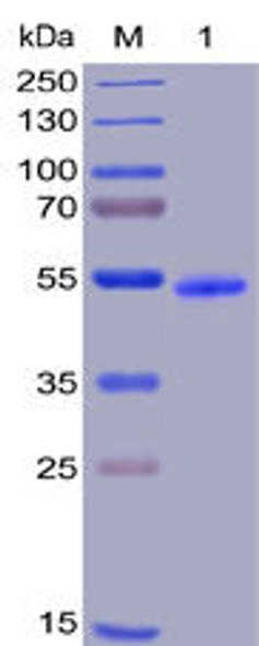 Human GITR Recombinant Protein hFc-His Tag HDPT0018